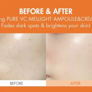 Dr.Ceuracle Pure Vc Mellight Cream 5