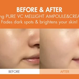 Dr.Ceuracle Pure Vc Mellight Cream 6